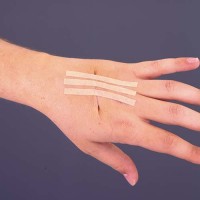 Suture Strips are made of flexible, non-woven material that allows the strips to yield to the movement of skin. 